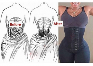 Why waist trainers are bad